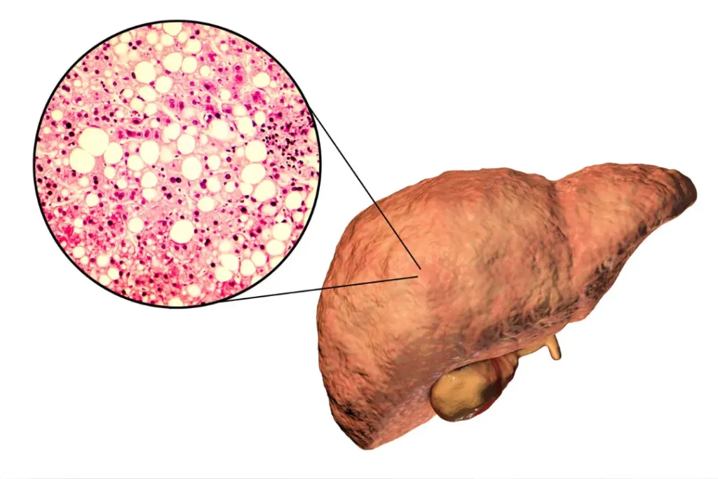 Human liver. 